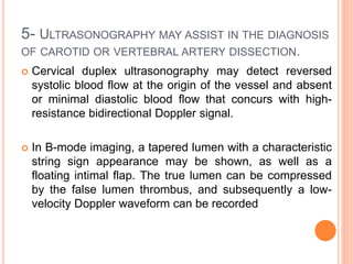 5- ULTRASONOGRAPHY MAY ASSIST IN THE DIAGNOSIS
OF CAROTID OR VERTEBRAL ARTERY DISSECTION.
 Cervical duplex ultrasonography may detect reversed
systolic blood flow at the origin of the vessel and absent
or minimal diastolic blood flow that concurs with high-
resistance bidirectional Doppler signal.
 In B-mode imaging, a tapered lumen with a characteristic
string sign appearance may be shown, as well as a
floating intimal flap. The true lumen can be compressed
by the false lumen thrombus, and subsequently a low-
velocity Doppler waveform can be recorded
 