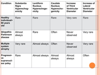 Condition Substantia
Nigra
Hyperechog-
enicity
Lentiform
Nucleus
Hyperechoge-
nicity
Caudate
Nucleus
Hyperecho-
genicity
Increase
of Third
Ventricular
Diameter
Increase of
Lateral
Ventricular
Diameter
Healthy
individual>
60 years
old
Rare Rare Rare Very rare Rare
Idiopathic
Parkinson
disease
Almost
always
Rare Often Never
observed
Very rare
Multiple
system
atrophy
Very rare Almost always Often Never
observed
Very rare
Progressi-
ve
supranucl-
ear palsy
Rare Almost always Almost
always
Almost
always
Often
 