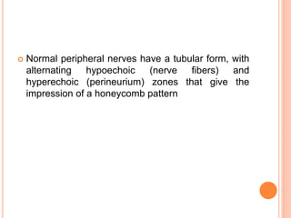  Normal peripheral nerves have a tubular form, with
alternating hypoechoic (nerve fibers) and
hyperechoic (perineurium) zones that give the
impression of a honeycomb pattern
 