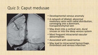 Neurospot | PPTX
