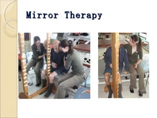 Mirror Therapy 