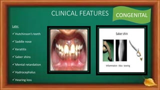 CLINICAL FEATURES
Late:
Hutchinson’s teeth
Saddle nose
Keratitis
Saber shins
Mental retardation
Hydrocephalus
Hearing loss
CONGENITAL
 