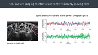 Functional Ultrasound (fUS) Imaging in the Brain of Awake Behaving Mice ...