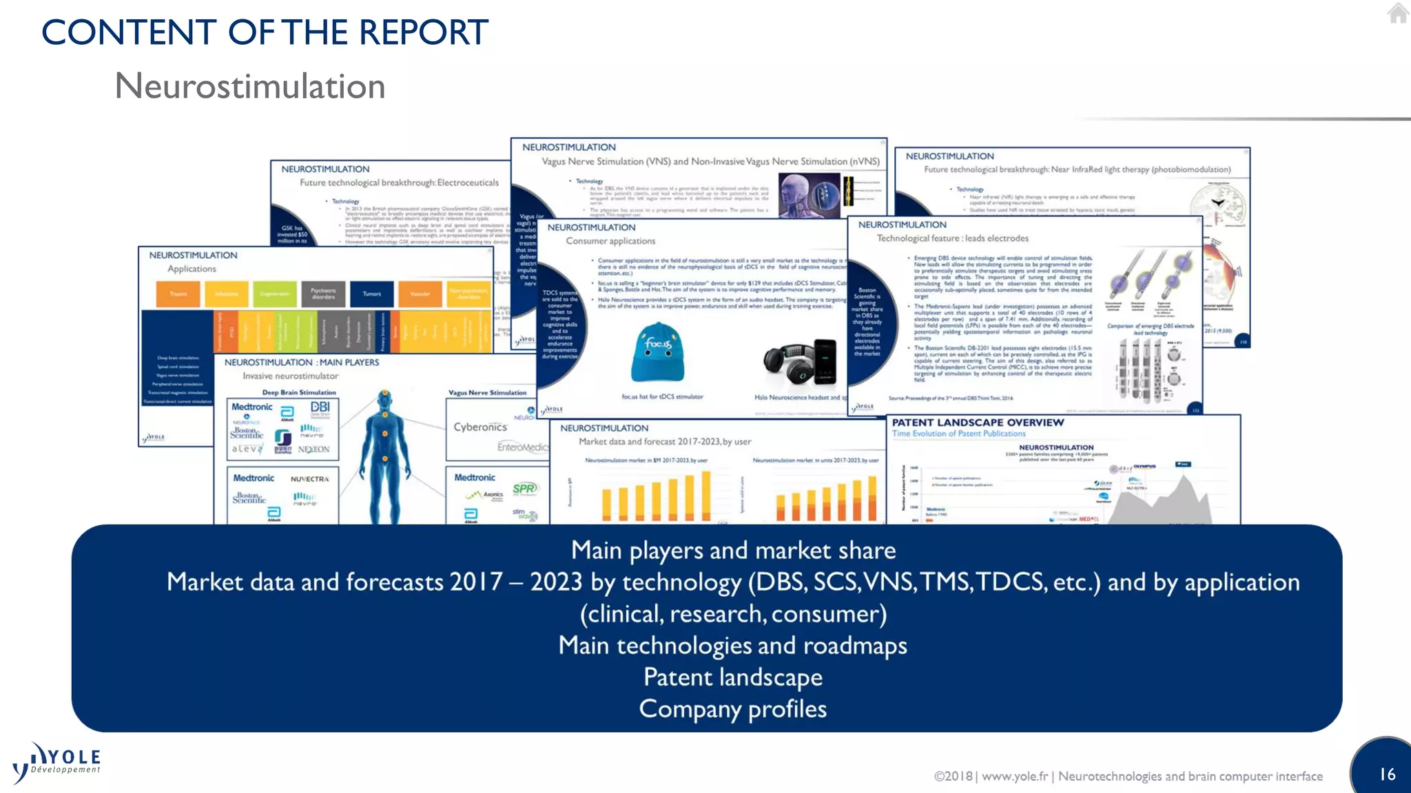 16
CONTENT OF THE REPORT
Neurostimulation
 