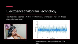 Electroencephalogram Technology
Test that tracks electrical activity in your brain using small electric discs (electrodes)
attached to your scalp.
Raw Coverage of Brain activity through EEG
scan
 