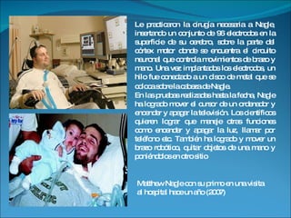Le practicaron la cirugía necesaria a Nagle, insertando un conjunto de 96 electrodos en la superficie de su cerebro, sobre la parte del córtex motor donde se encuentra el circuito neuronal que controla movimientos de brazo y mano. Una vez implantados los electrodos, un hilo fue conectado a un disco de metal que se coloca sobre la cabeza de Nagle . En las pruebas realizadas hasta la fecha, Nagle ha logrado mover el cursor de un ordenador y encender y apagar la televisión. Los científicos quieren lograr que maneje otras funciones como encender y apagar la luz, llamar por teléfono etc. También ha logrado y mover un brazo robótico, quitar objetos de una mano y poniéndolos en otro sitio Matthew Nagle con su primo en una visita al hospital hace un año (2007) 