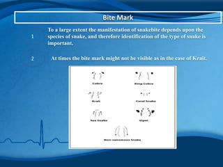 Bite Mark
1
To a large extent the manifestation of snakebite depends upon the
species of snake, and therefore identification of the type of snake is
important.
2 At times the bite mark might not be visible as in the case of Krait.
 