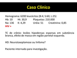 Caso Clínico
Hemograma: 6200 leucócitos (B:4; S:60; L:25)
Hb: 10 Ht: 30,9 Plaquetas: 210.000
Na: 136 K: 4,29 Uréia: 51 Creatinina: 0,85
HIV +
TC de crânio: lesões hipodensas esparsas em substância
branca, efeito de massa em região parietal esquerda.
HD: Neurotoxoplamose ou linfoma?
Paciente internado para investigação.
 