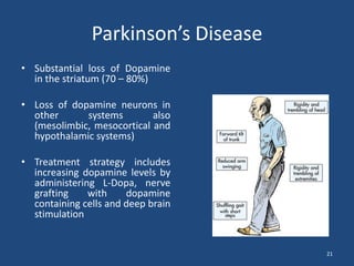 Parkinson’s Disease
• Substantial loss of Dopamine
  in the striatum (70 – 80%)

• Loss of dopamine neurons in
  other      systems        also
  (mesolimbic, mesocortical and
  hypothalamic systems)

• Treatment strategy includes
  increasing dopamine levels by
  administering L-Dopa, nerve
  grafting    with     dopamine
  containing cells and deep brain
  stimulation


                                     21
 
