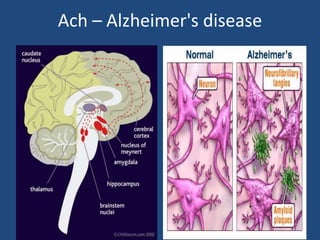 Ach – Alzheimer's disease
 
