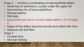 Stage 2 - involves a nonhealing corneal epithelial defect
• Acute loss of epithelium, usually under the upper lid
• Surrounding rim of loose epithelium
• Stromal edema
• DM folds
• a punched-out oval or circular shape defect– chr of stage
2
• Edges of the defect become smooth and rolled with time
• Aqueous cell and flare
Stage 3
• Corneal ulcer
• Stromal melting
• corneal perforation
 