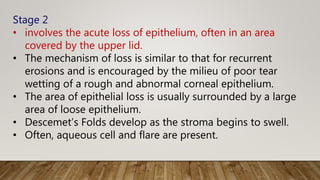 Stage 2
• involves the acute loss of epithelium, often in an area
covered by the upper lid.
• The mechanism of loss is similar to that for recurrent
erosions and is encouraged by the milieu of poor tear
wetting of a rough and abnormal corneal epithelium.
• The area of epithelial loss is usually surrounded by a large
area of loose epithelium.
• Descemet’s Folds develop as the stroma begins to swell.
• Often, aqueous cell and flare are present.
 
