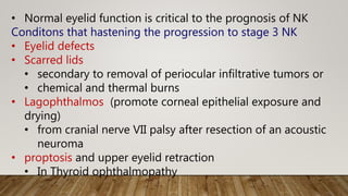 • Normal eyelid function is critical to the prognosis of NK
Conditons that hastening the progression to stage 3 NK
• Eyelid defects
• Scarred lids
• secondary to removal of periocular infiltrative tumors or
• chemical and thermal burns
• Lagophthalmos (promote corneal epithelial exposure and
drying)
• from cranial nerve VII palsy after resection of an acoustic
neuroma
• proptosis and upper eyelid retraction
• In Thyroid ophthalmopathy
 