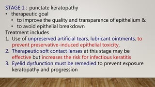 STAGE 1 : punctate keratopathy
• therapeutic goal
• to improve the quality and transparence of epithelium &
• to avoid epithelial breakdown
Treatment includes
1. Use of unpreserved artificial tears, lubricant ointments, to
prevent preservative-induced epithelial toxicity.
2. Therapeutic soft contact lenses at this stage may be
effective but increases the risk for infectious keratitis
3. Eyelid dysfunction must be remedied to prevent exposure
keratopathy and progression
 