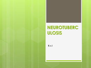 NEUROTUBERC
ULOSIS
R.v.l
 