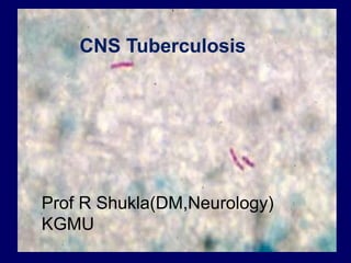 CNS Tuberculosis
Prof R Shukla(DM,Neurology)
KGMU
 
