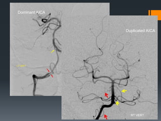 Neurovascular anatomy | PPTX