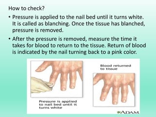 How to check?
• Pressure is applied to the nail bed until it turns white.
It is called as blanching. Once the tissue has blanched,
pressure is removed.
• After the pressure is removed, measure the time it
takes for blood to return to the tissue. Return of blood
is indicated by the nail turning back to a pink color.
 