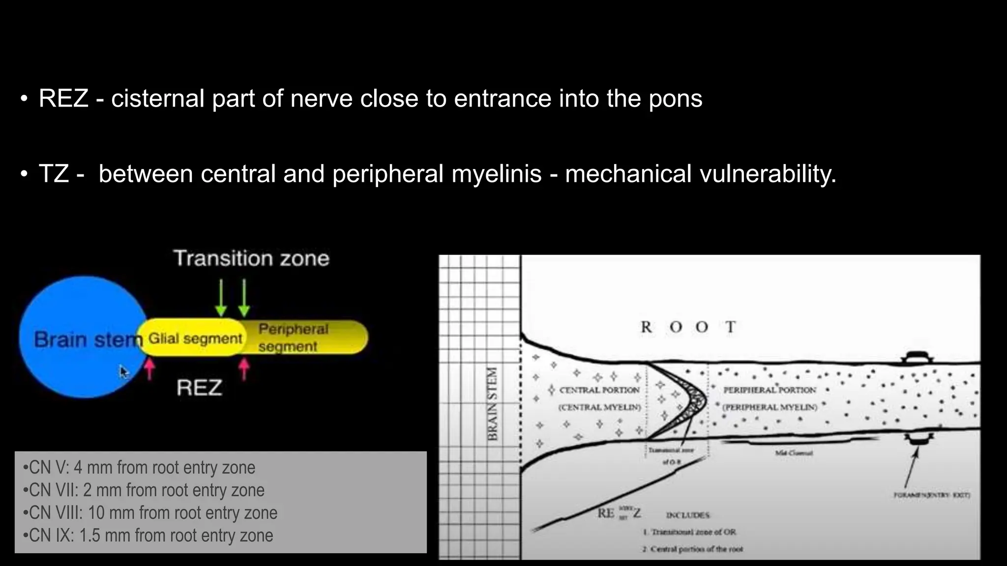 Neurovascular compression syndromes.pptx