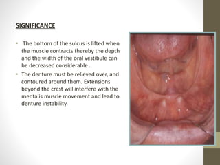 SIGNIFICANCE
• The bottom of the sulcus is lifted when
the muscle contracts thereby the depth
and the width of the oral vestibule can
be decreased considerable .
• The denture must be relieved over, and
contoured around them. Extensions
beyond the crest will interfere with the
mentalis muscle movement and lead to
denture instability.
 