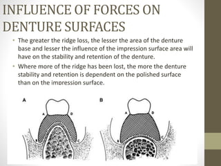 INFLUENCE OF FORCES ON
DENTURE SURFACES
• The greater the ridge loss, the lesser the area of the denture
base and lesser the influence of the impression surface area will
have on the stability and retention of the denture.
• Where more of the ridge has been lost, the more the denture
stability and retention is dependent on the polished surface
than on the impression surface.
 