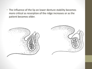• The influence of the lip on lower denture stability becomes
more critical as resorption of the ridge increases or as the
patient becomes older.
 