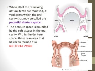 • When all of the remaining
natural teeth are removed, a
void exists within the oral
cavity that may be called the
potential denture space.
• The denture space is bounded
by the soft tissues in the oral
cavity. Within the denture
space, there is an area that
has been termed as a
NEUTRAL ZONE.
 