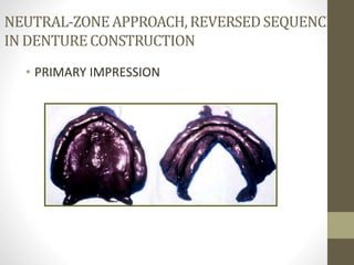 NEUTRAL-ZONEAPPROACH,REVERSEDSEQUENCE
IN DENTURECONSTRUCTION
• PRIMARY IMPRESSION
 