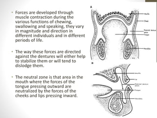 • Forces are developed through
muscle contraction during the
various functions of chewing,
swallowing and speaking, they vary
in magnitude and direction in
different individuals and in different
periods of life.
• The way these forces are directed
against the dentures will either help
to stabilize them or will tend to
dislodge them.
• The neutral zone is that area in the
mouth where the forces of the
tongue pressing outward are
neutralized by the forces of the
cheeks and lips pressing inward.
 