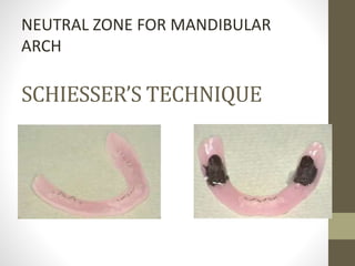SCHIESSER’S TECHNIQUE
NEUTRAL ZONE FOR MANDIBULAR
ARCH
 
