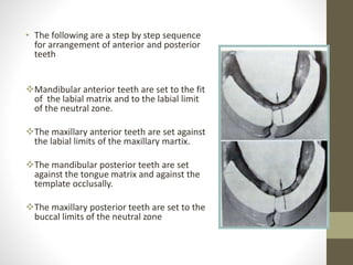 • The following are a step by step sequence
for arrangement of anterior and posterior
teeth
Mandibular anterior teeth are set to the fit
of the labial matrix and to the labial limit
of the neutral zone.
The maxillary anterior teeth are set against
the labial limits of the maxillary martix.
The mandibular posterior teeth are set
against the tongue matrix and against the
template occlusally.
The maxillary posterior teeth are set to the
buccal limits of the neutral zone
 