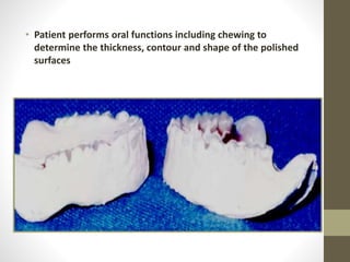 • Patient performs oral functions including chewing to
determine the thickness, contour and shape of the polished
surfaces
 