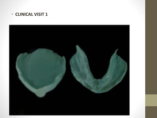 • CLINICAL VISIT 1
 