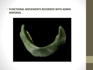 • FUNCTIONAL MOVEMENTS RECORDED WITH ADMIX
MATERIAL
 