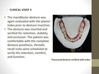 • CLINICAL VISIST 4
• The mandibular denture was
again evaluated with the plaster
index prior to denture insertion.
• The denture was inserted and
verified for retention, stability,
and occlusion. The patient was
comfortable with the complete
denture prosthesis. Periodic
recall visits were scheduled to
verify the retention, comfort,
and function.
Processed denture verified with index
 