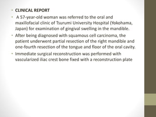 • CLINICAL REPORT
• A 57-year-old woman was referred to the oral and
maxillofacial clinic of Tsurumi University Hospital (Yokohama,
Japan) for examination of gingival swelling in the mandible.
• After being diagnosed with squamous cell carcinoma, the
patient underwent partial resection of the right mandible and
one-fourth resection of the tongue and floor of the oral cavity.
• Immediate surgical reconstruction was performed with
vascularized iliac crest bone fixed with a reconstruction plate
 