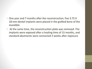 • One year and 7 months after the reconstruction, five 3.75 X
18-mm dental implants were placed in the grafted bone of the
mandible
• At the same time, the reconstruction plate was removed. The
implants were exposed after a healing time of 15 months, and
standard abutments were connected 2 weeks after exposure
 