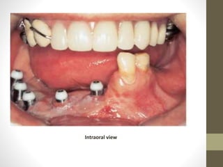 Intraoral view
 