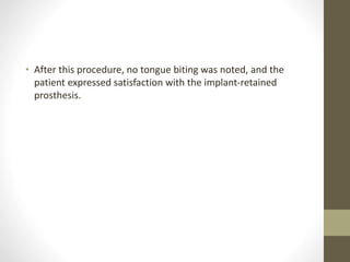 • After this procedure, no tongue biting was noted, and the
patient expressed satisfaction with the implant-retained
prosthesis.
 