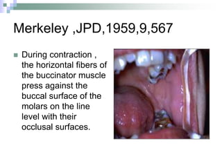Merkeley ,JPD,1959,9,567
 During contraction ,
the horizontal fibers of
the buccinator muscle
press against the
buccal surface of the
molars on the line
level with their
occlusal surfaces.
0
10
20
30
40
50
60
70
80
90
1st
Qtr
2nd
Qtr
3rd
Qtr
4th
Qtr
East
West
North
 