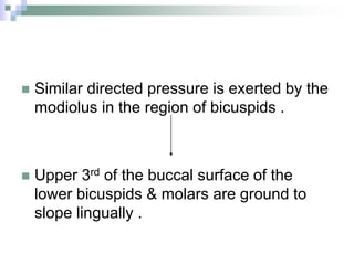  Similar directed pressure is exerted by the
modiolus in the region of bicuspids .
 Upper 3rd of the buccal surface of the
lower bicuspids & molars are ground to
slope lingually .
 
