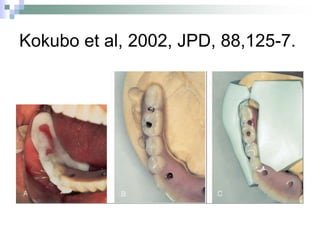 Kokubo et al, 2002, JPD, 88,125-7.
 