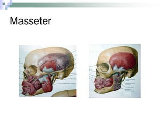 Masseter
 