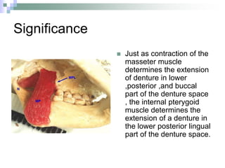 Significance
 Just as contraction of the
masseter muscle
determines the extension
of denture in lower
,posterior ,and buccal
part of the denture space
, the internal pterygoid
muscle determines the
extension of a denture in
the lower posterior lingual
part of the denture space.
 