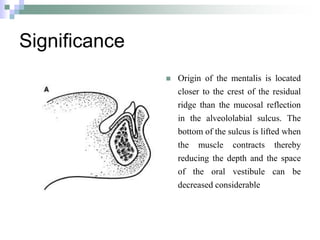 Significance
 Origin of the mentalis is located
closer to the crest of the residual
ridge than the mucosal reflection
in the alveololabial sulcus. The
bottom of the sulcus is lifted when
the muscle contracts thereby
reducing the depth and the space
of the oral vestibule can be
decreased considerable
 