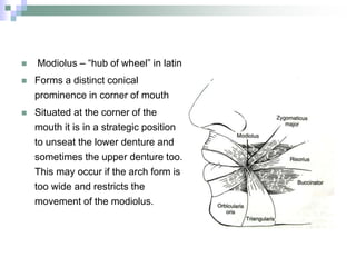  Modiolus – “hub of wheel” in latin
 Forms a distinct conical
prominence in corner of mouth
 Situated at the corner of the
mouth it is in a strategic position
to unseat the lower denture and
sometimes the upper denture too.
This may occur if the arch form is
too wide and restricts the
movement of the modiolus.
 