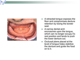  A retracted tongue exposes the
floor and compromises denture
retention by losing the border
seal.
 A narrow dental arch
encroaches upon the tongue,
which can no longer occupy it’s
rest position and tends to push
the lower denture out.
 Occlusal plane placed at the
level of tongue helps stabilize
the denture and guide the food
on to it.
 