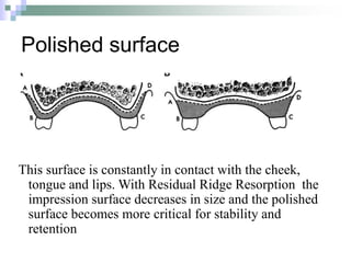 Polished surface
This surface is constantly in contact with the cheek,
tongue and lips. With Residual Ridge Resorption the
impression surface decreases in size and the polished
surface becomes more critical for stability and
retention
 
