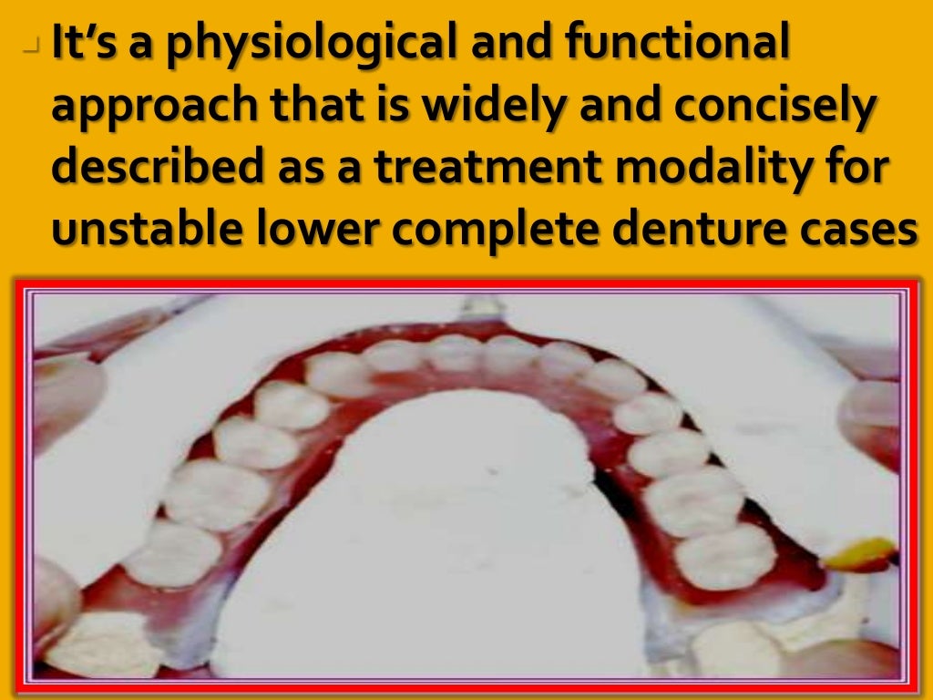 Neutral zone impression technique