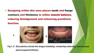  Designing within this zone places teeth and flange
contours and thickness to utilize muscle balance,
reducing dislodgement and enhancing prosthesis
function.
Fig 1, 2 : Boundaries include the tongue (medially), cheeks/lips (laterally), and occlusal
plane (superior/inferior).
1 2
 
